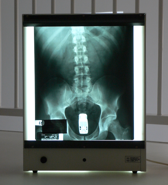 How Ryan Dunn's Butt X-Ray Became a Work of Art
